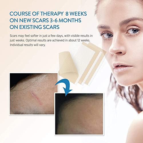 Soft Silicone Scar Sheets Strips, 8 Sheets G59382