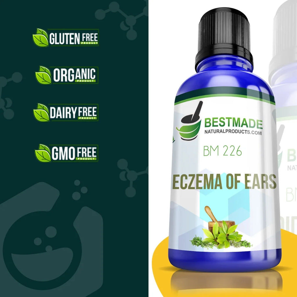 Natural Remedy for Eczema of Ears Q569123
